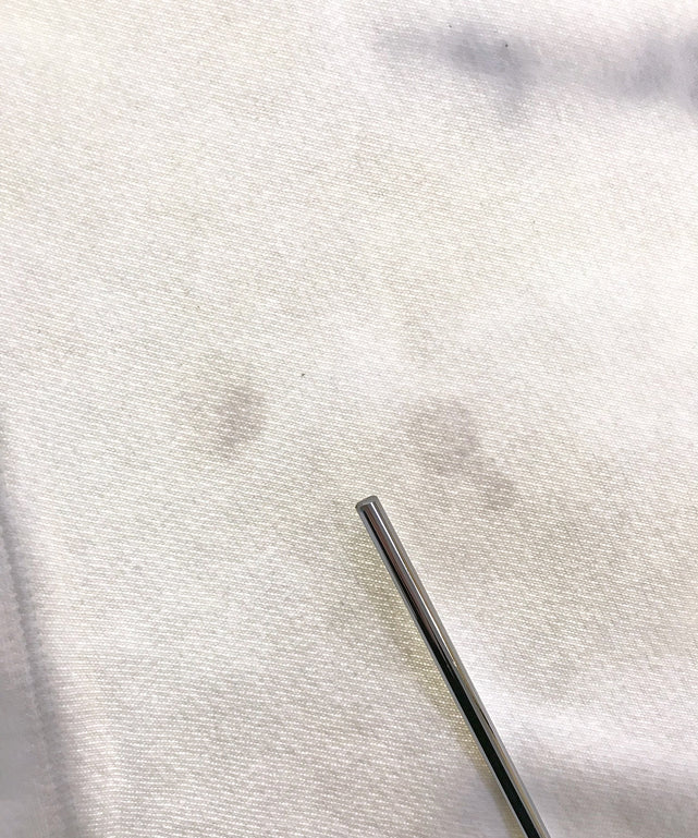 チャンピオンリバース